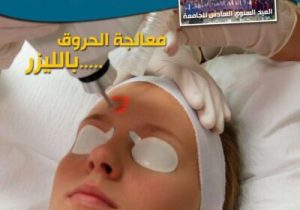 5صورة العدد